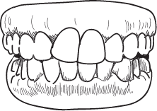 Straight teeth tretment form