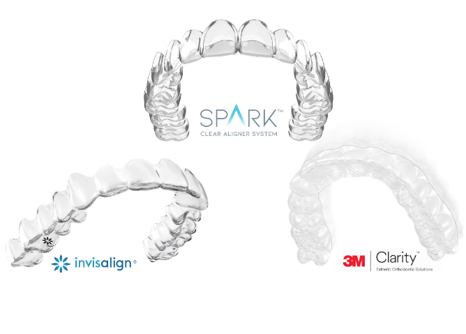Comparison of different types of clear aligners
