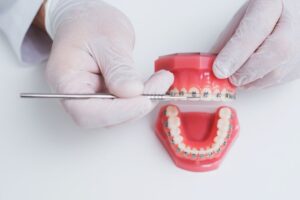 Orthodontist using model to demonstrate how braces work